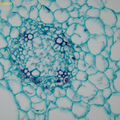 Typical dicot root,ranunculus mature root cs