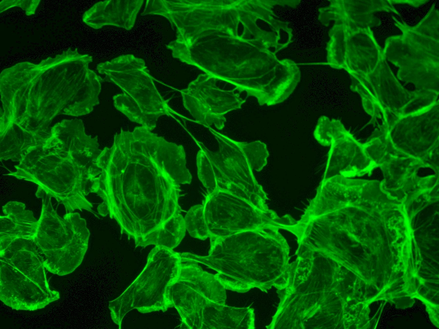 Green Fluorescent Image