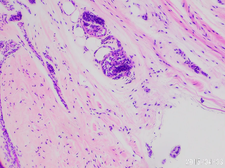 10X Objective