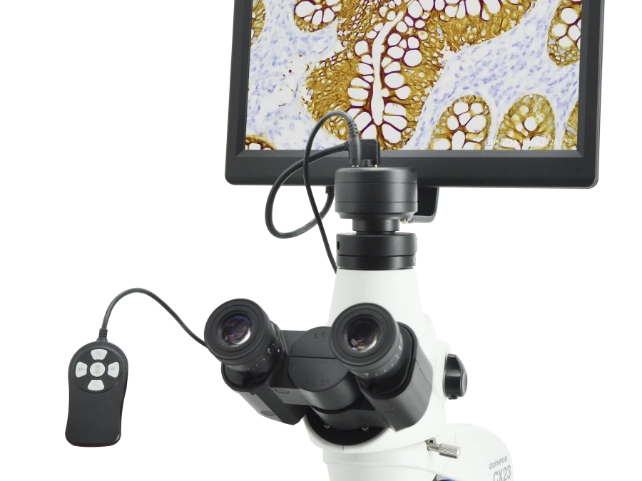 CE210 and its Microscope