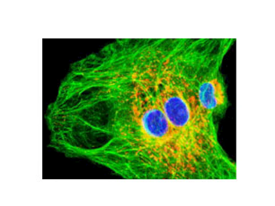 Fluorescent Observe