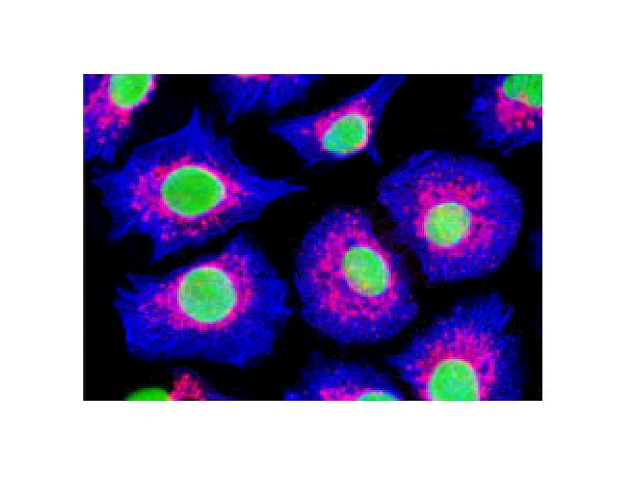 Fluorescent Observe
