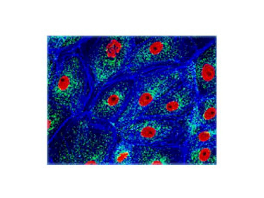 Fluorescent Observe