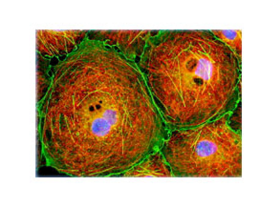 Fluorescent Observe