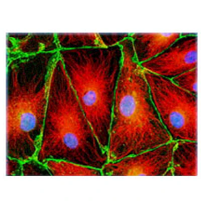 Fluorescent Observe