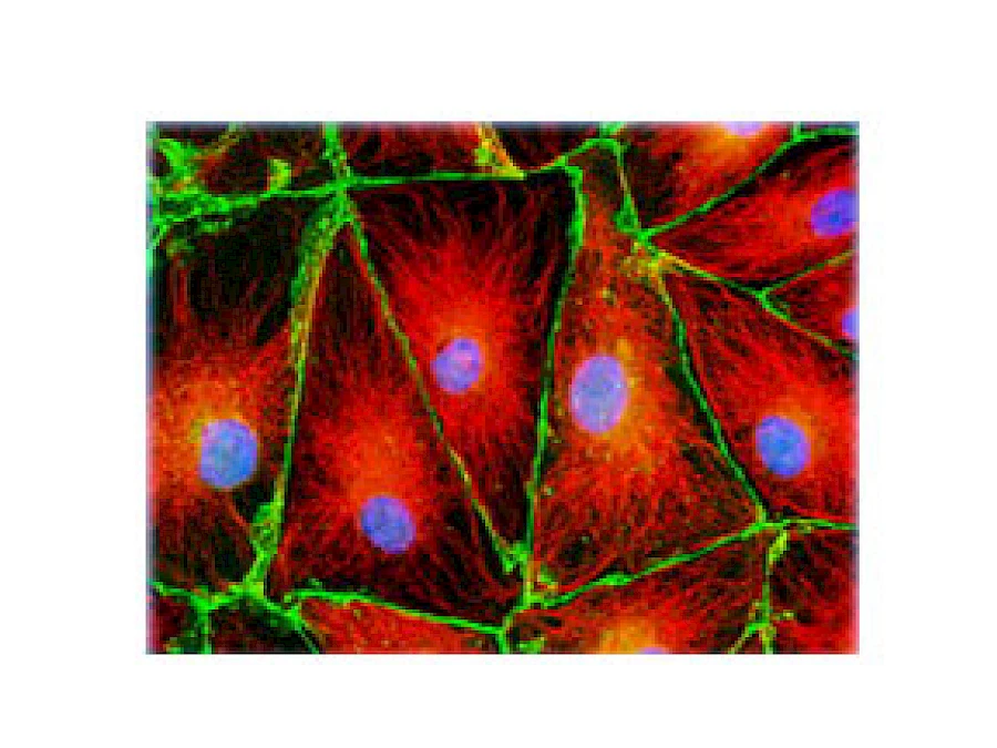 Fluorescent Observe