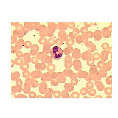VMB200I 100X-400X Inverted Biological Microscope with Pendulum Rotate Condenser image 7