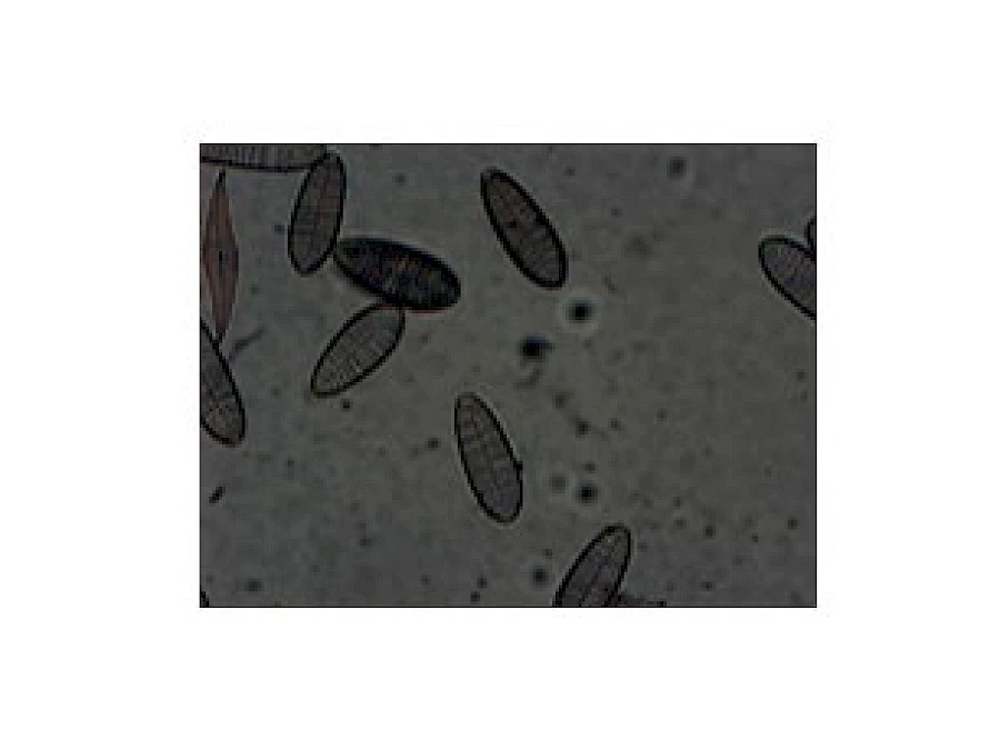 VMB300I 100X-400X Binocular Inverted Biological Microscope with Infinity Optical System gallery image 9