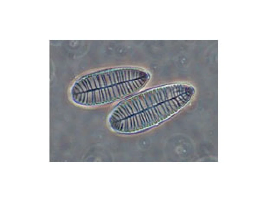 VMB300I 100X-400X Binocular Inverted Biological Microscope with Infinity Optical System gallery image 11