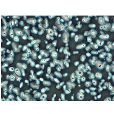 Negative Phase Observe
