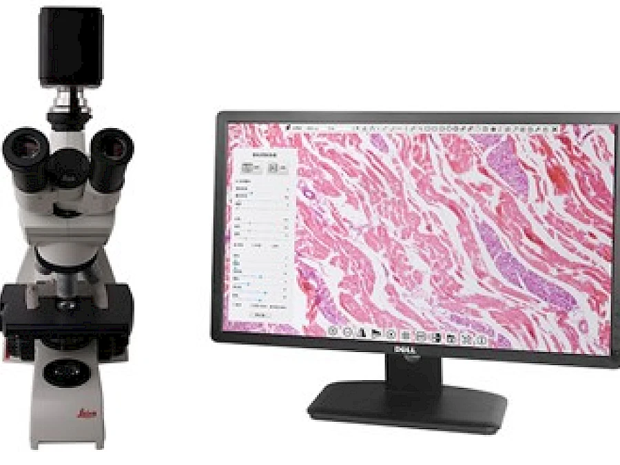XCAMLITE4K with its connected Microscope