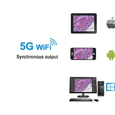 5G WIFI+ Network+ HDMI Simultaneous Output