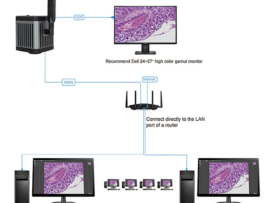 5G WIFI+ Network+ HDMI Simultaneous Output