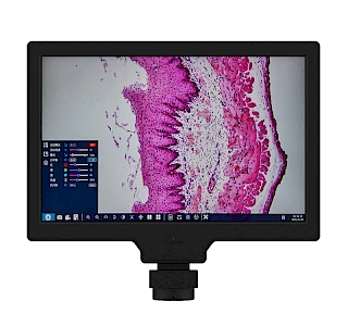 10inch 2MP HDMI & USB/UVC Output Microscope Monitor Integrated Screen with Measurement Software