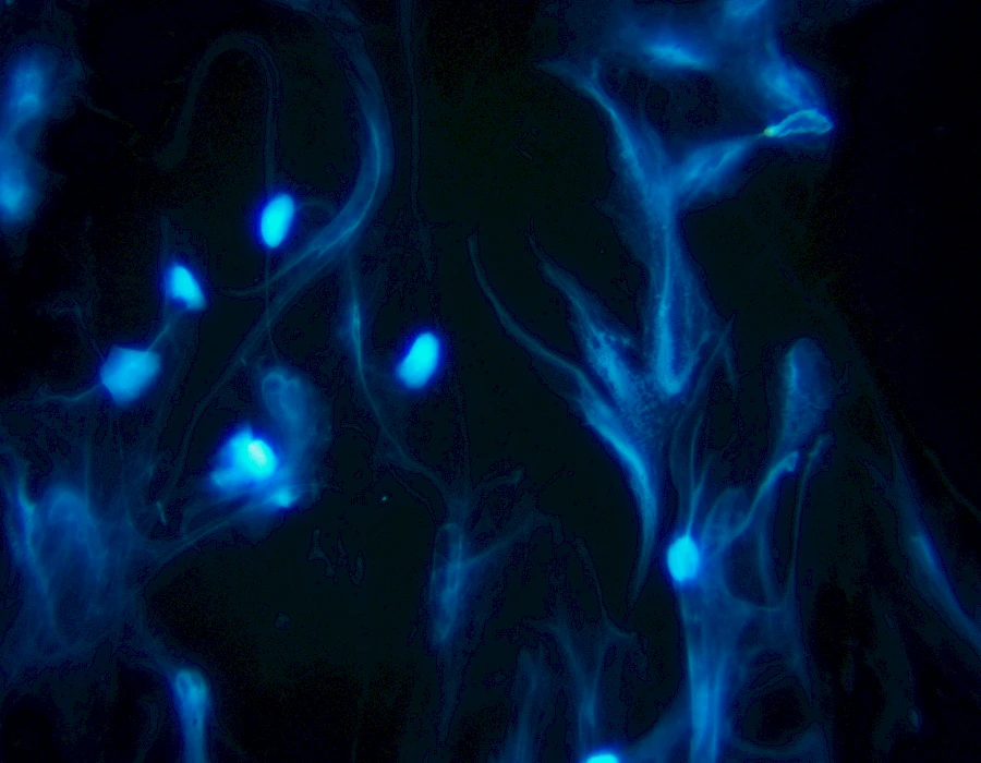 Images captured using the MTR3 series cooled camera and fluorescence microscopy system