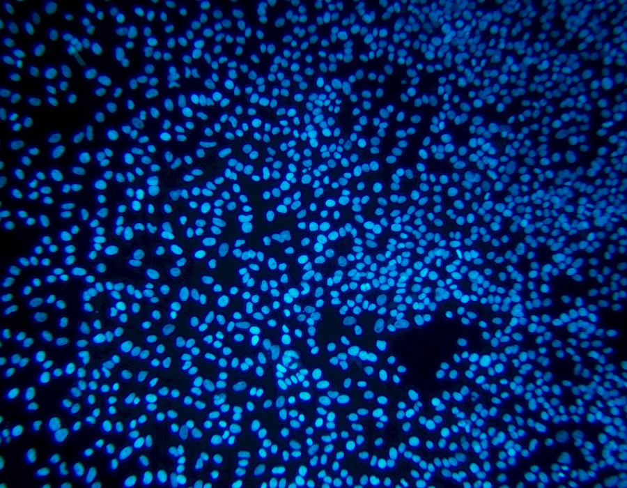 Images captured using the MTR3 series cooled camera and fluorescence microscopy system