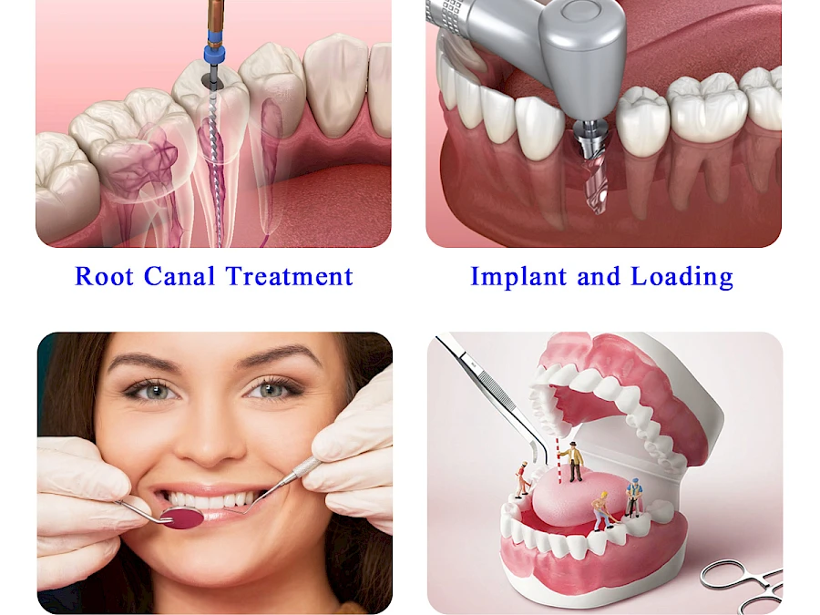 Application of VMS102DS Dental Microscope